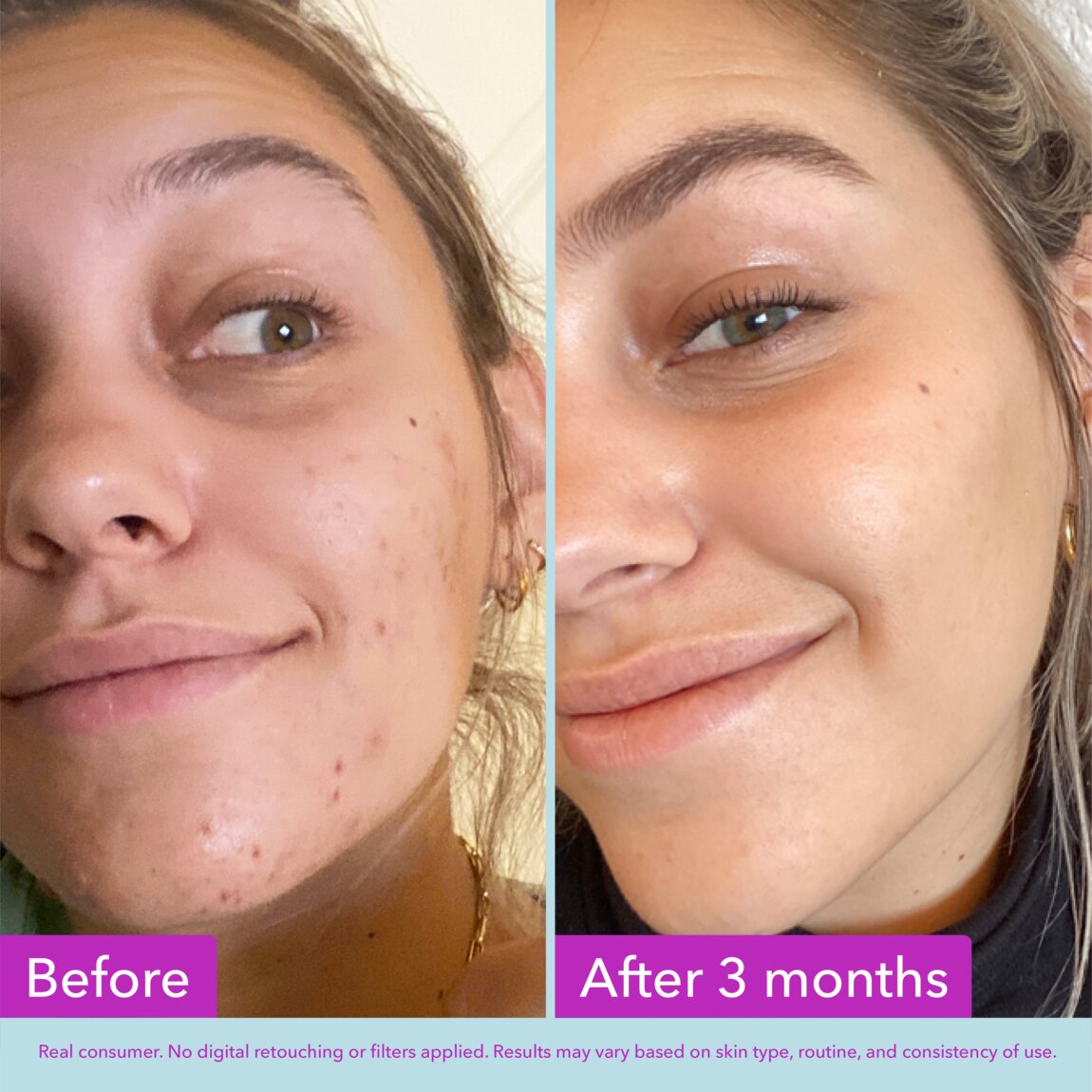 niacinamide-brightening-toner-f8 zb_p.jpg